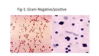 Fig-1: Gram-Negative/positive
 