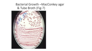 Bacterial Growth –MacConkey agar
& Tube Broth (Fig-7)
 