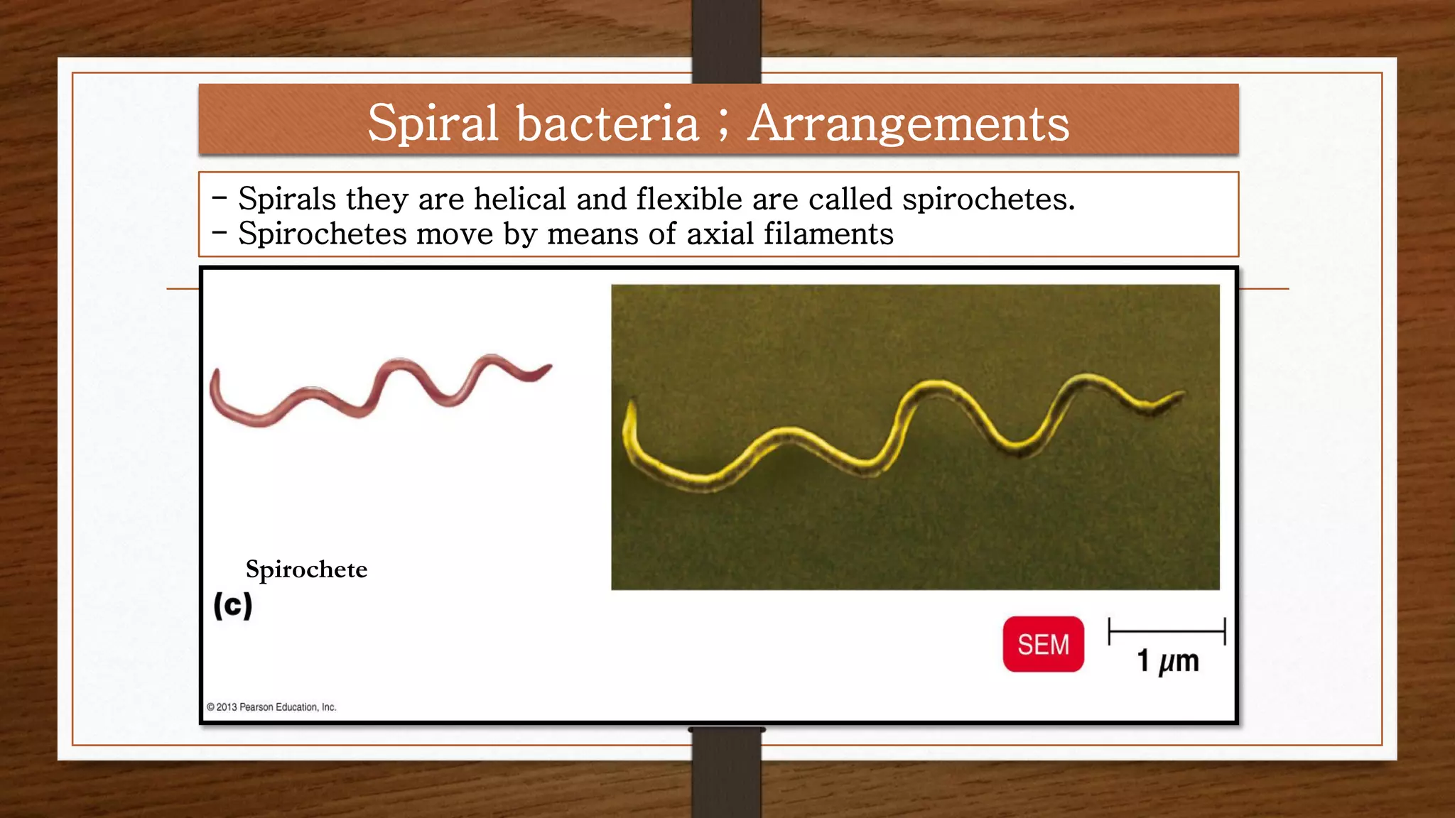 Spiral bacteria ; Arrangements
- Spirals they are helical and flexible are called spirochetes.
- Spirochetes move by means of axial filaments
Spirochete
 