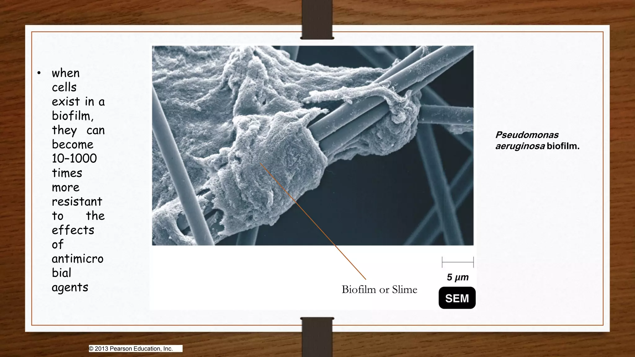 Pseudomonas
aeruginosa biofilm.
© 2013 Pearson Education, Inc.
Biofilm or Slime
• when
cells
exist in a
biofilm,
they can
become
10–1000
times
more
resistant
to the
effects
of
antimicro
bial
agents
 