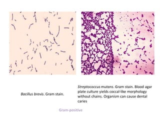 Bacillus brevis. Gram stain.
Streptococcus mutans. Gram stain. Blood agar
plate culture yields coccal-like morphology
without chains. Organism can cause dental
caries
Gram-positive
 