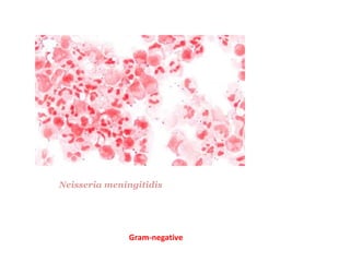 Neisseria meningitidis
Gram-negative
 