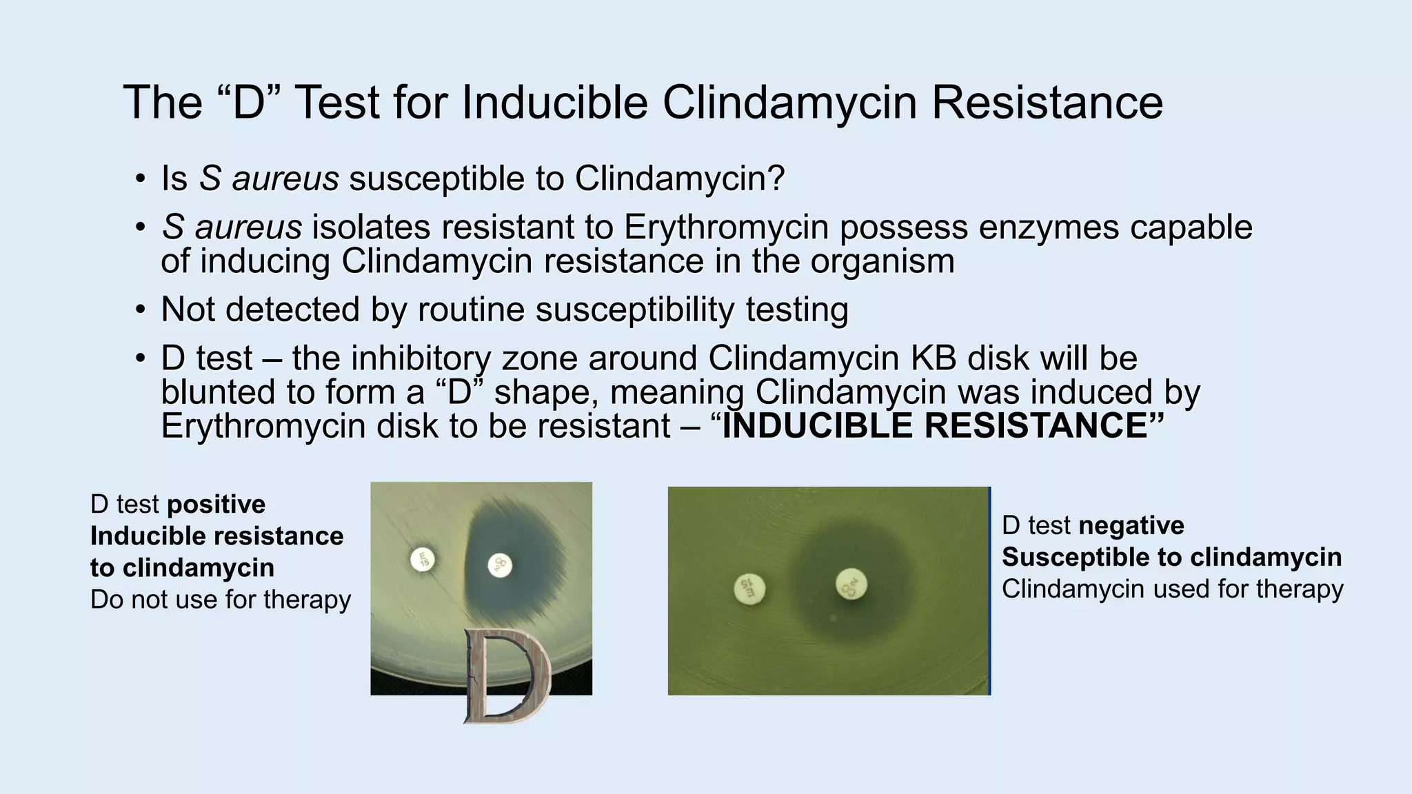 The “D” Test for Inducible Clindamycin Resistance
• Is S aureus susceptible to Clindamycin?
• S aureus isolates resistant to Erythromycin possess enzymes capable
of inducing Clindamycin resistance in the organism
• Not detected by routine susceptibility testing
• D test – the inhibitory zone around Clindamycin KB disk will be
blunted to form a “D” shape, meaning Clindamycin was induced by
Erythromycin disk to be resistant – “INDUCIBLE RESISTANCE”
D test positive
Inducible resistance
to clindamycin
Do not use for therapy
D test negative
Susceptible to clindamycin
Clindamycin used for therapy
 