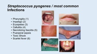 Streptococcus pyogenes / most common
Infections
• Pharyngitis (1)
• Impetigo (2)
• Erysipelas (3)
• Cellulitis (4)
• Necrotizing fasciitis (5)
• Puerperal sepsis
• Toxic Shock
• Scarlet fever (6)
3
4
5
6
1 2
 