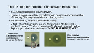 The “D” Test for Inducible Clindamycin Resistance
• Is S aureus susceptible to Clindamycin?
• S aureus isolates resistant ...