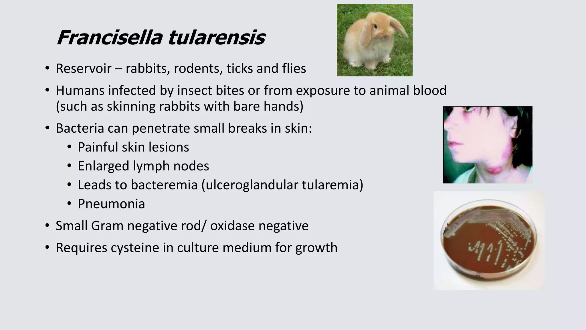 • Reservoir – rabbits, rodents, ticks and flies
• Humans infected by insect bites or from exposure to animal blood
(such as skinning rabbits with bare hands)
• Bacteria can penetrate small breaks in skin:
• Painful skin lesions
• Enlarged lymph nodes
• Leads to bacteremia (ulceroglandular tularemia)
• Pneumonia
• Small Gram negative rod/ oxidase negative
• Requires cysteine in culture medium for growth
Francisella tularensis
 