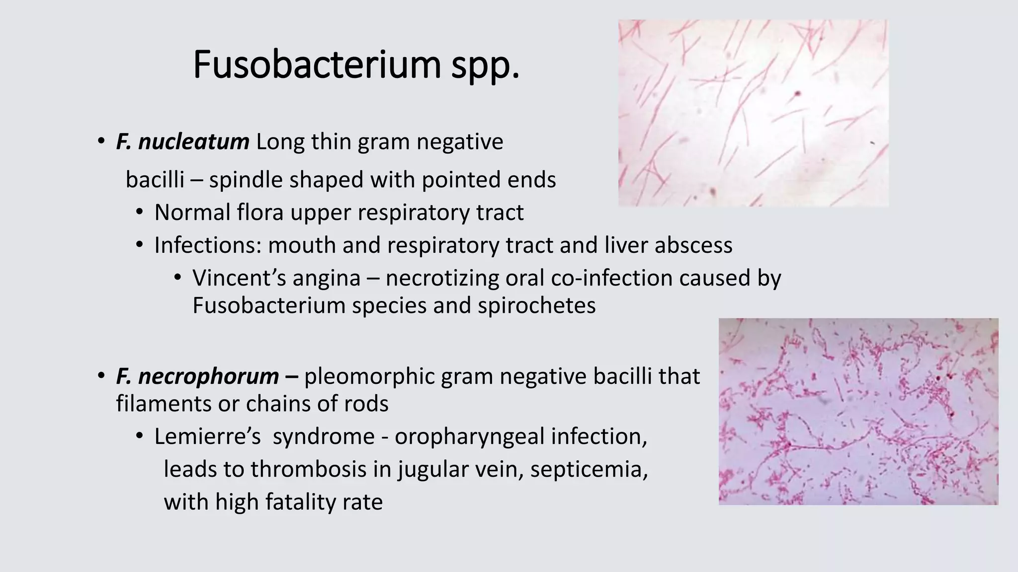 Fusobacterium spp.
• F. nucleatum Long thin gram negative
bacilli – spindle shaped with pointed ends
• Normal flora upper respiratory tract
• Infections: mouth and respiratory tract and liver abscess
• Vincent’s angina – necrotizing oral co-infection caused by
Fusobacterium species and spirochetes
• F. necrophorum – pleomorphic gram negative bacilli that
filaments or chains of rods
• Lemierre’s syndrome - oropharyngeal infection,
leads to thrombosis in jugular vein, septicemia,
with high fatality rate
 