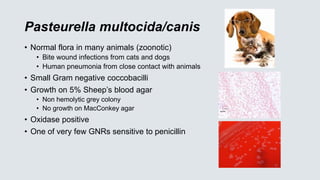 Pasteurella multocida/canis
• Normal flora in many animals (zoonotic)
• Bite wound infections from cats and dogs
• Human pneumonia from close contact with animals
• Small Gram negative coccobacilli
• Growth on 5% Sheep’s blood agar
• Non hemolytic grey colony
• No growth on MacConkey agar
• Oxidase positive
• One of very few GNRs sensitive to penicillin
 