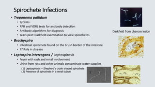 Spirochete Infections
• Treponema pallidum
• Syphilis
• RPR and VDRL tests for antibody detection
• Antibody algorithms for diagnosis
• Years past: Darkfield examination to view spirochetes
• Brachyspira
• Intestinal spirochete found on the brush border of the intestine
• ?? Role in disease
• Leptospira interrogans / Leptospirosis
• Fever with rash and renal involvement
• Urine from rats and other animals contaminate water supplies
Darkfield from chancre lesion
(1) Leptospirosis – Shepherd’s crook shaped spirochete
(2) Presence of spirochete in a renal tubule
(2)
1
 