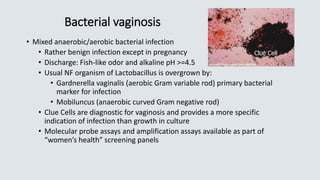 Bacterial vaginosis
• Mixed anaerobic/aerobic bacterial infection
• Rather benign infection except in pregnancy
• Discharge: Fish-like odor and alkaline pH >=4.5
• Usual NF organism of Lactobacillus is overgrown by:
• Gardnerella vaginalis (aerobic Gram variable rod) primary bacterial
marker for infection
• Mobiluncus (anaerobic curved Gram negative rod)
• Clue Cells are diagnostic for vaginosis and provides a more specific
indication of infection than growth in culture
• Molecular probe assays and amplification assays available as part of
“women’s health” screening panels
Clue Cell
 