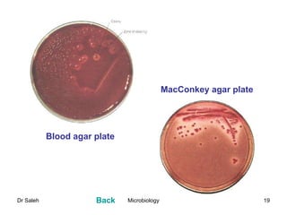 MacConkey agar plate Blood agar plate Back 