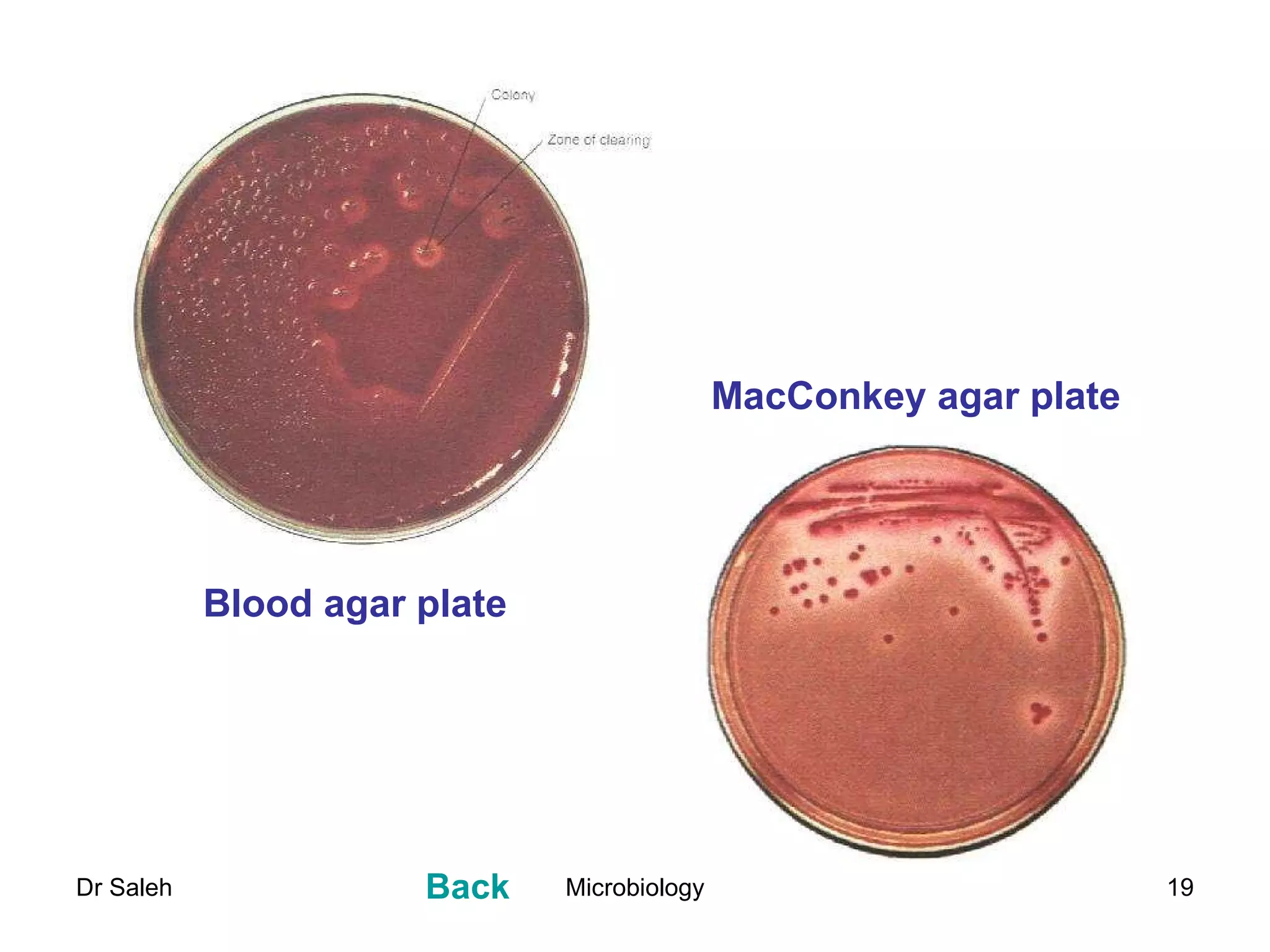 MacConkey agar plate Blood agar plate Back 