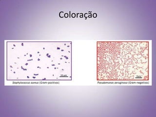 Coloração
 