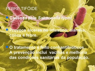 FEBRE TIFÓIDE
 Causada pela Salmonella typhi,
 Provoca úlceras no intestino, diarréia,
cólica e febre.
 O tratamento é feito com antibióticos.
A prevenção inclui vacinas e melhoria
das condições sanitárias da população.
 