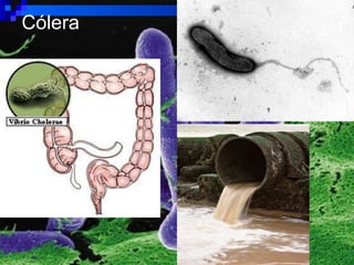 Cólera
 