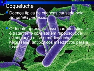 Coqueluche
 Doença típica de crianças causada pela
Bordetella pertussis.
 O doente apresenta tosse característica, e
o tratamento consiste em repouso, boa
alimentação e, se o médico achar
necessário, antibióticos e sedativos para a
tosse.
 