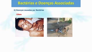 6) Doenças causadas por Bactérias
Cólera
Bactérias e Doenças Associadas
 