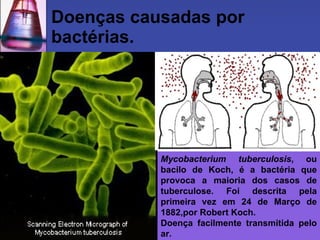 Doenças causadas por
bactérias.




           Mycobacterium tuberculosis, ou
           bacilo de Koch, é a bactéria que
           provoca a maioria dos casos de
           tuberculose. Foi descrita pela
           primeira vez em 24 de Março de
           1882,por Robert Koch.
           Doença facilmente transmitida pelo
           ar.
 