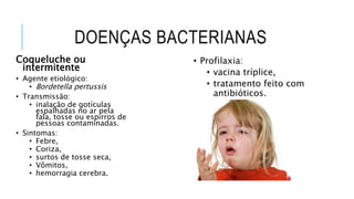 DOENÇAS BACTERIANAS
Coqueluche ou
intermitente
• Agente etiológico:
• Bordetella pertussis
• Transmissão:
• inalação de gotículas
espalhadas no ar pela
fala, tosse ou espirros de
pessoas contaminadas.
• Sintomas:
• Febre,
• Coriza,
• surtos de tosse seca,
• Vômitos,
• hemorragia cerebra.
• Profilaxia:
• vacina tríplice,
• tratamento feito com
antibióticos.
 