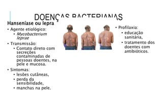 DOENÇAS BACTERIANAS
Hanseníase ou lepra
• Agente etiológico:
• Mycobacterium
leprae
• Transmissão:
• Contato direto com
secreções
contaminadas de
pessoas doentes, na
pele e mucosa.
• Sintomas:
• lesões cutâneas,
• perda da
sensibilidade,
• manchas na pele.
• Profilaxia:
• educação
sanitária,
• tratamento dos
doentes com
antibióticos.
 