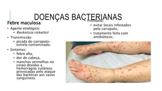 DOENÇAS BACTERIANAS
Febre maculosa
• Agente etiológico:
• Reckettsia rickettsii
• Transmissão:
• picada do carrapato-
estrela contaminado.
• Sintomas:
• febre alta,
• dor de cabeça,
• manchas vermelhas no
corpo devidas a
hemorragias cutâneas
provocadas pelo ataque
das bactérias aos vasos
sanguíneos.
• Profilaxia:
• evitar locais infestados
pelo carrapato,
• tratamento feito com
antibióticos.
 