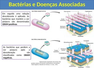 Bactérias e Doenças Associadas
A coloração de GRAM foi
desenvolvida em 1984 pelo
bacteriologista dinamarquês
Hans Gram.
Utilizando corantes a base de
iodo as bactérias são coradas
de púrpura, pois o iodo
impregna na parede celular.
Em seguida uma solução
descolorante é aplicada. As
bactérias que mantém a cor
púrpura são denominadas
GRAM positivas.
As bactérias que perdem a
cor púrpura após a
descoloração são
classificadas como GRAM
negativas.
 