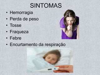 SINTOMAS
•   Hemorragia
•   Perda de peso
•   Tosse
•   Fraqueza
•   Febre
•   Encurtamento da respiração
 