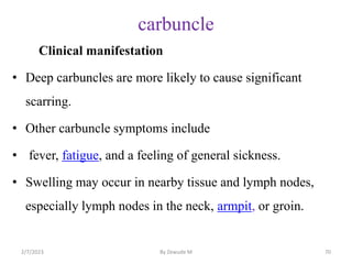 BACTWERIAL INFECTIONS OF THE SKIN.pptx