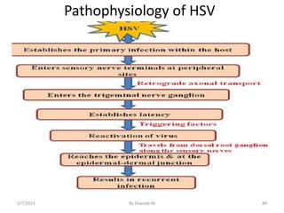 Pathophysiology of HSV
2/7/2023 By Zewude M 89
 