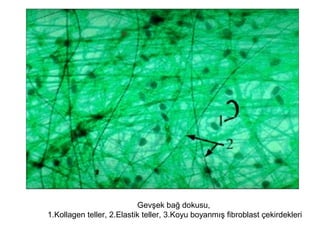 Gevşek bağ dokusu,
1.Kollagen teller, 2.Elastik teller, 3.Koyu boyanmış fibroblast çekirdekleri
 
