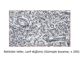 Retiküler teller, Lenf düğümü (Gümüşle boyama; x 250)
 