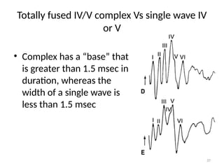 BRAINSTEM EVOKED AUDITORY RESPONSE and VEP (VISUAL EVOKED POTENTIALS ...