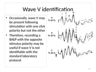 BRAINSTEM EVOKED AUDITORY RESPONSE and VEP (VISUAL EVOKED POTENTIALS ...