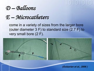 D – Balloons
E – Microcatheters
come in a variety of sizes from the larger bore
(outer diameter 3 F) to standard size (2.7 F) to
very small bore (2 F).
(Golzarian et al., 2006 )
 