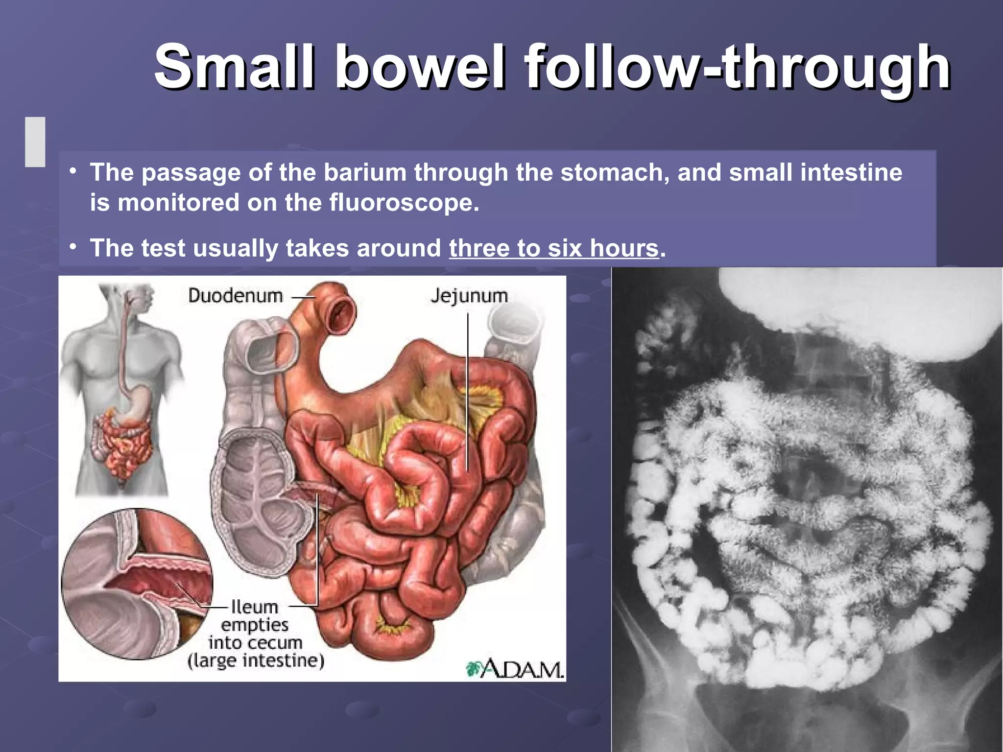 Ba examination of gi tract | PPT