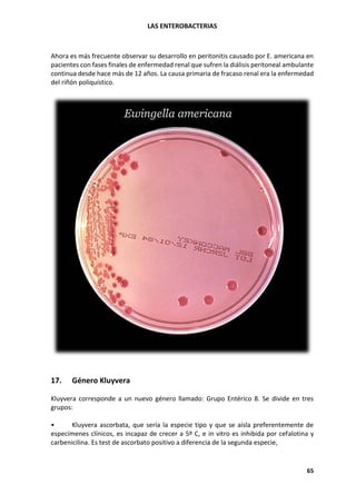 LAS ENTEROBACTERIAS
65
Ahora es más frecuente observar su desarrollo en peritonitis causado por E. americana en
pacientes con fases finales de enfermedad renal que sufren la diálisis peritoneal ambulante
continua desde hace más de 12 años. La causa primaria de fracaso renal era la enfermedad
del riñón poliquístico.
17. Género Kluyvera
Kluyvera corresponde a un nuevo género llamado: Grupo Entérico 8. Se divide en tres
grupos:
• Kluyvera ascorbata, que sería la especie tipo y que se aísla preferentemente de
especímenes clínicos, es incapaz de crecer a 5º C, e in vitro es inhibida por cefalotina y
carbenicilina. Es test de ascorbato positivo a diferencia de la segunda especie,
 