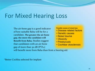 Bone Anchored Hearing Aid JC | PPT