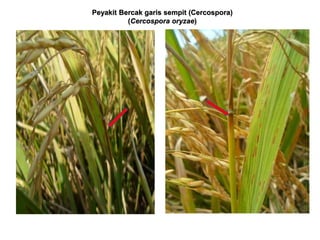 Peyakit Bercak garis sempit (Cercospora)
(Cercospora oryzae)
 