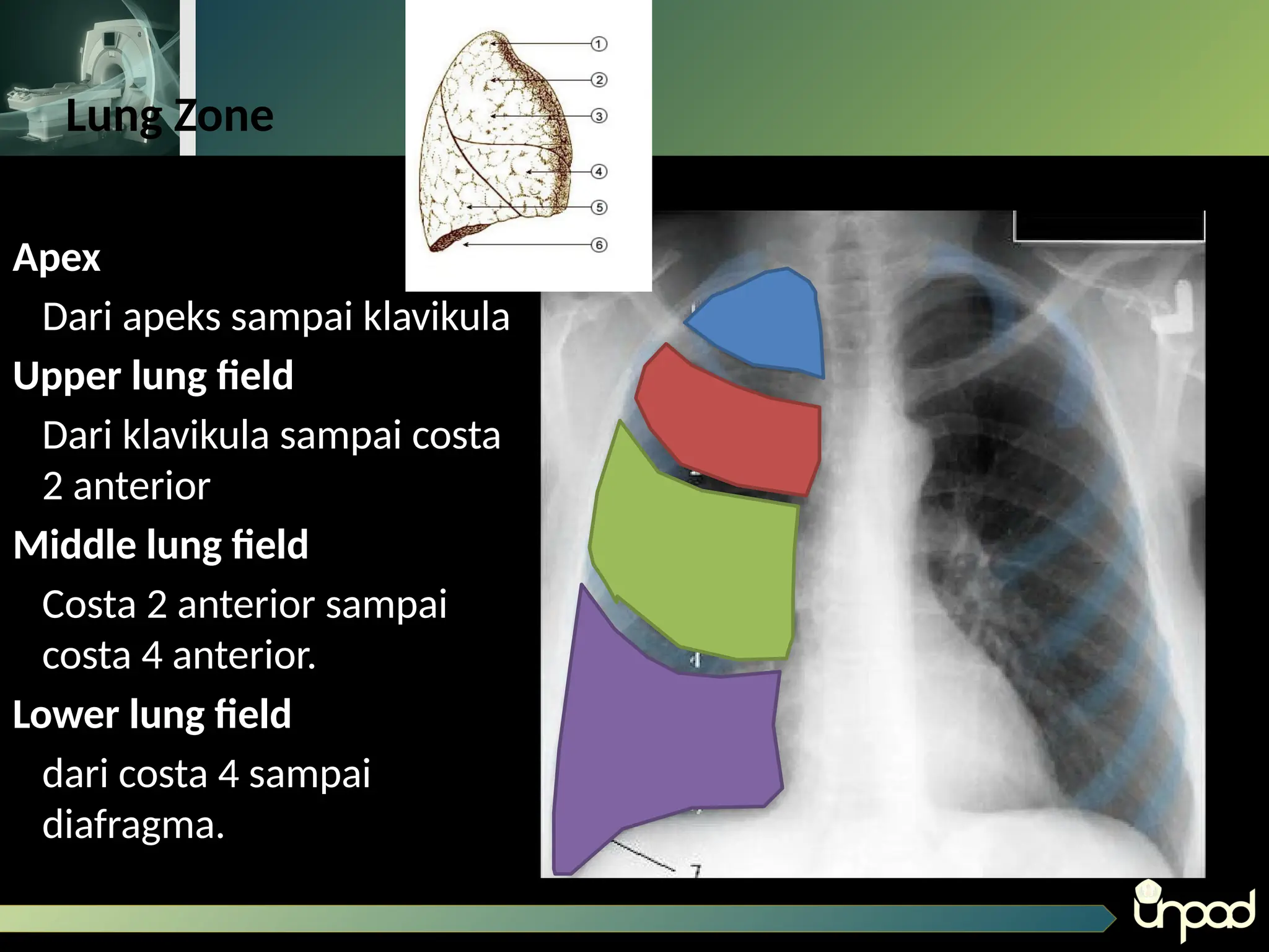 Loopografi Normal Radiologi Bahan Thorax Normal untuk radiologi pptx | PPTX