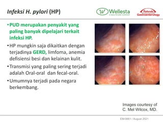 Bahasa_RTD_Peranan_Prosogan_dan_Pantozol_pada_tatalaksana_ARD__1_.pptx
