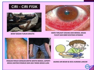 BERAT BADAN TURUN DRASTIS
MATA TERLIHAT CEKUNG DAN MERAH, MUKA
PUCAT DAN BIBIR KEHITAM-HITAMAN
CIRI - CIRI FISIK
TANGAN PENUH DENGAN BINTIK-BINTIK MERAH, SEPERTI
BEKAS GIGITAN NYAMUK DAN ADA TANDA BEKAS LUKA
BUANG AIR BESAR & KECIL KURANG LANCAR
 