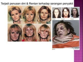 Terjadi penuaan dini & Rentan terhadap serangan penyakit
 