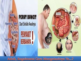 Bahaya perut buncit bagi kesehatan