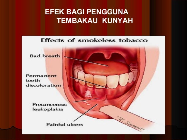 Bahaya rokok bagi kesehatan Bahaya rokok bagi kesehatan