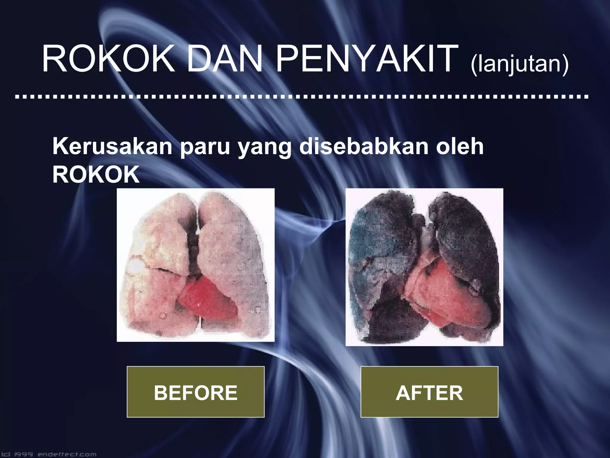 Bahaya rokok bagi remaja | PPT