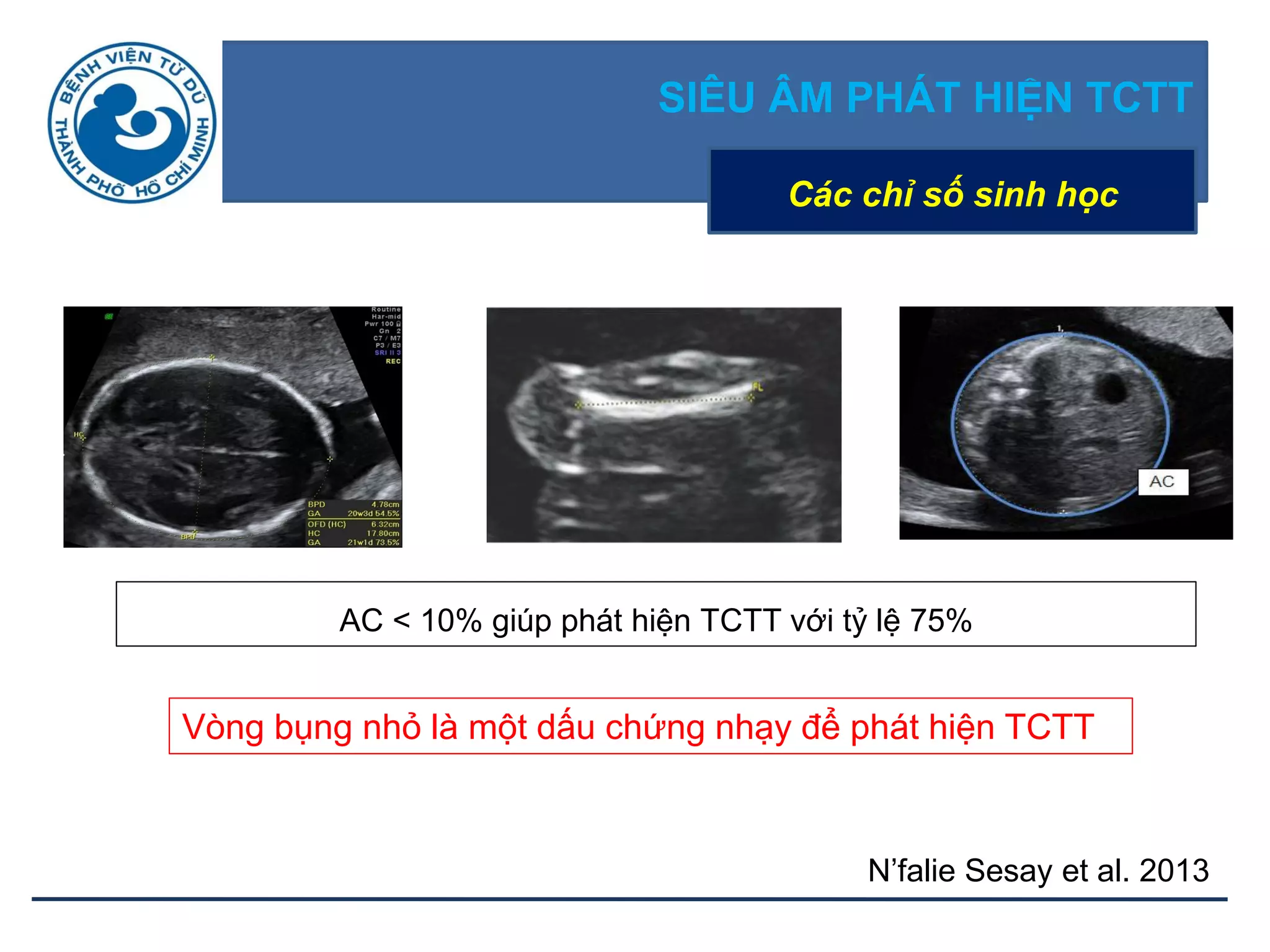 SIÊU ÂM PHÁT HIỆN TCTT
N’falie Sesay et al. 2013
Các chỉ số sinh học
Vòng bụng nhỏ là một dấu chứng nhạy để phát hiện TCTT
AC < 10% giúp phát hiện TCTT với tỷ lệ 75%
 