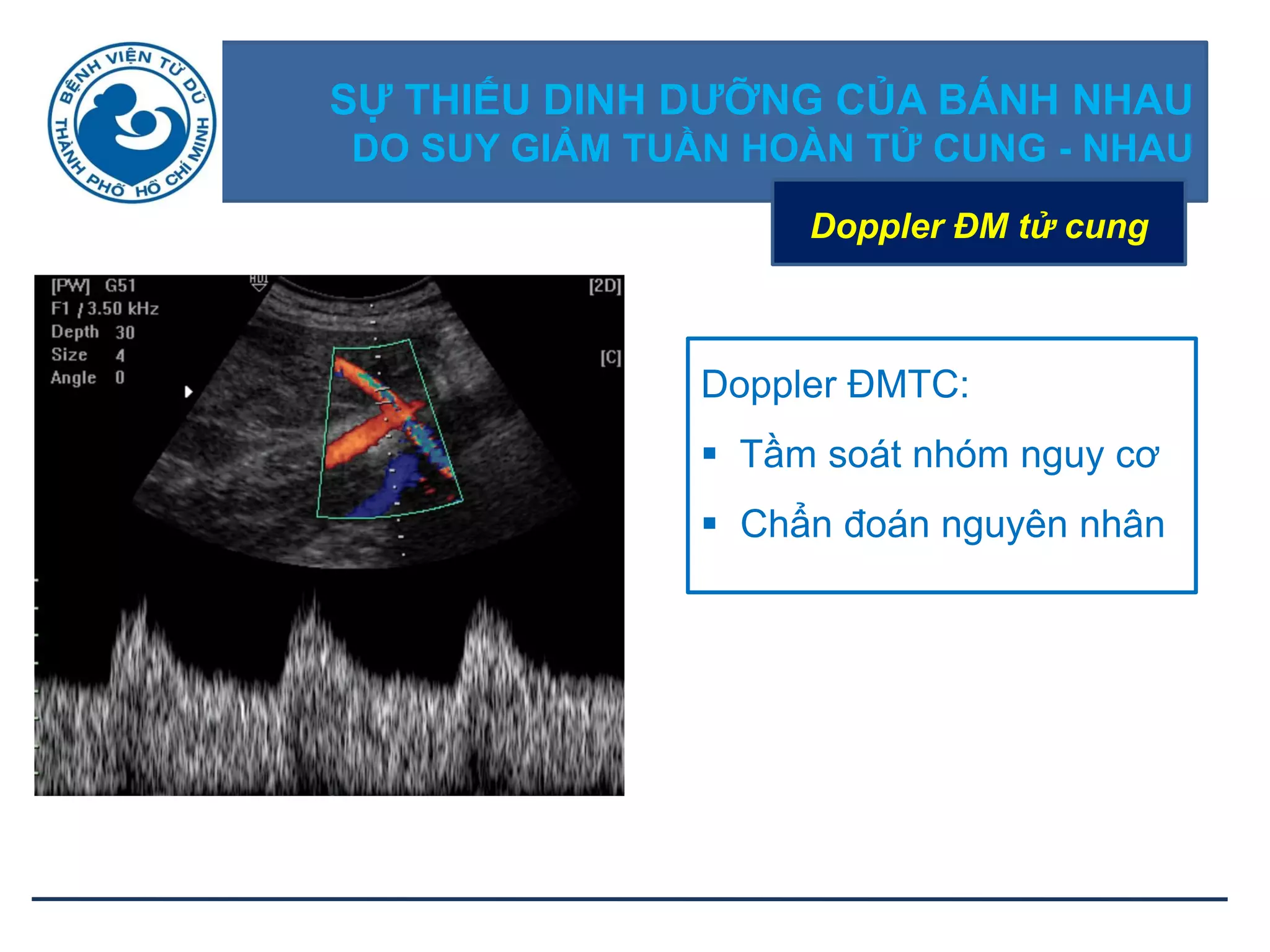 SỰ THIẾU DINH DƢỠNG CỦA BÁNH NHAU
DO SUY GIẢM TUẦN HOÀN TỬ CUNG - NHAU
Doppler ĐM tử cung
Doppler ĐMTC:
 Tầm soát nhóm nguy cơ
 Chẩn đoán nguyên nhân
 