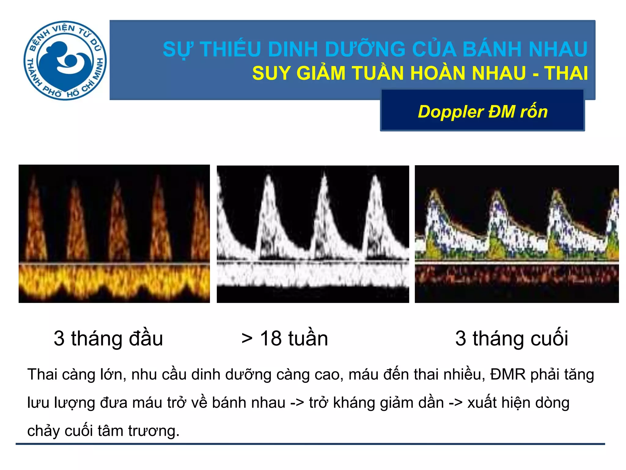 SỰ THIẾU DINH DƢỠNG CỦA BÁNH NHAU
SUY GIẢM TUẦN HOÀN NHAU - THAI
Doppler ĐM rốn
3 tháng đầu > 18 tuần 3 tháng cuối
Thai càng lớn, nhu cầu dinh dưỡng càng cao, máu đến thai nhiều, ĐMR phải tăng
lưu lượng đưa máu trở về bánh nhau -> trở kháng giảm dần -> xuất hiện dòng
chảy cuối tâm trương.
 