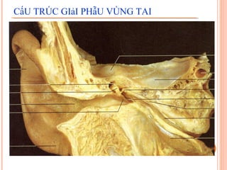 CấU TRÚC GIảI PHẫU VÙNG TAI
 