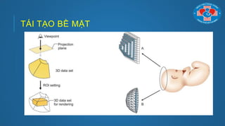 TÁI TẠO BỀ MẶT
 